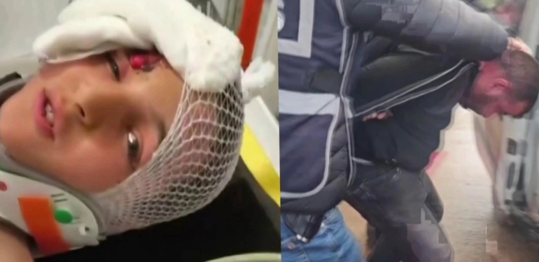 Vicdansız Dayı Tutuklandı, Minik Amir’in Durumu İyi